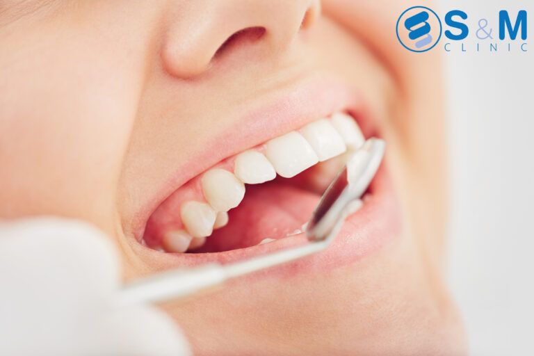 Checking Up Teeth
