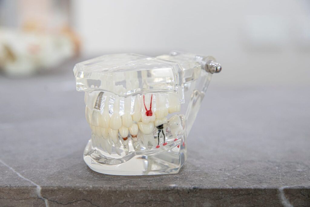 Cdsm Tratamientos Endodoncia