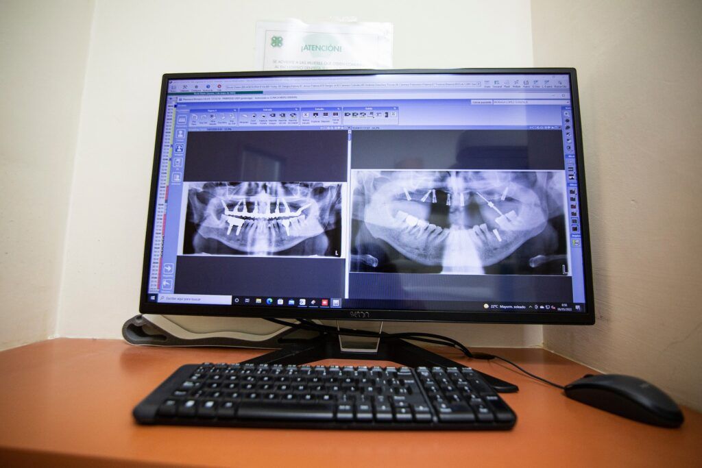 Cdsm Tratamientos Implantes
