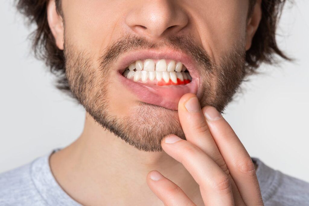 Cdsm Tratamientos Periodoncia